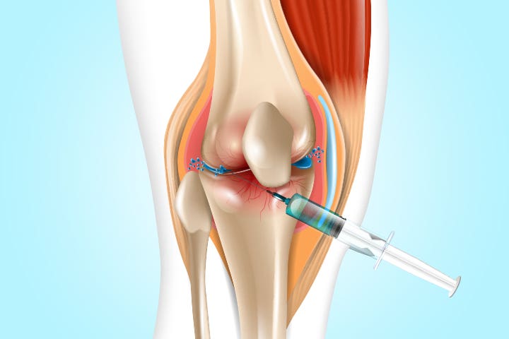 Dr. Ravi Kumar Entra Articular injection